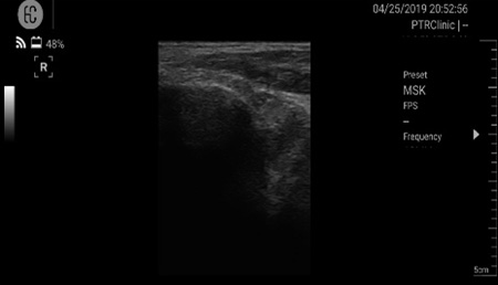 Musculoskeletal ultrasound