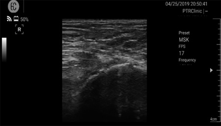 Musculoskeletal ultrasound