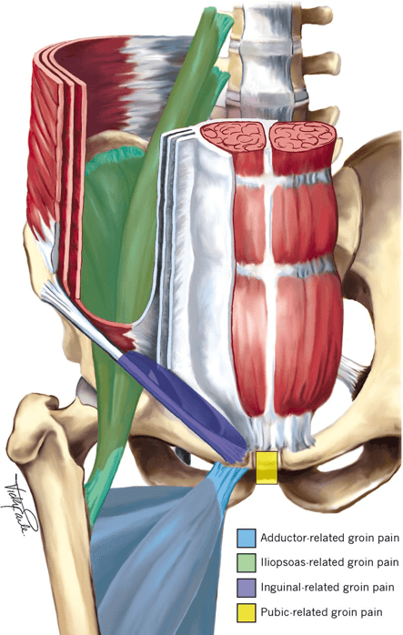 Potential hip pain